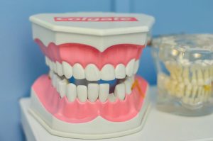 Wisdom tooth myths you should stop believing
