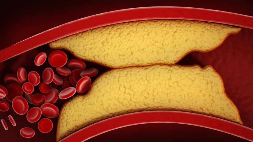 Catching up with metabolic health supplements: A roundup of the