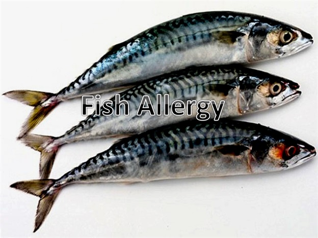 Fish Allergy