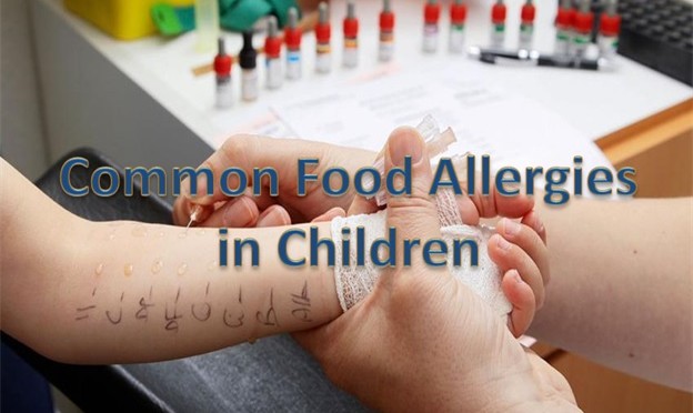 For Parents - Food Allergies In Children