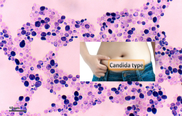 Candida Type Gut