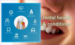 Dental Health And Conditions