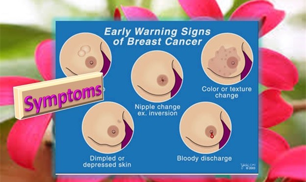 Symptoms of breast cancer