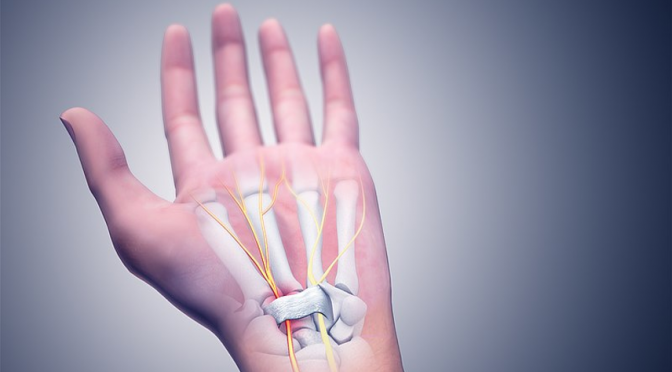 Get Relief from Carpal Tunnel Syndrome