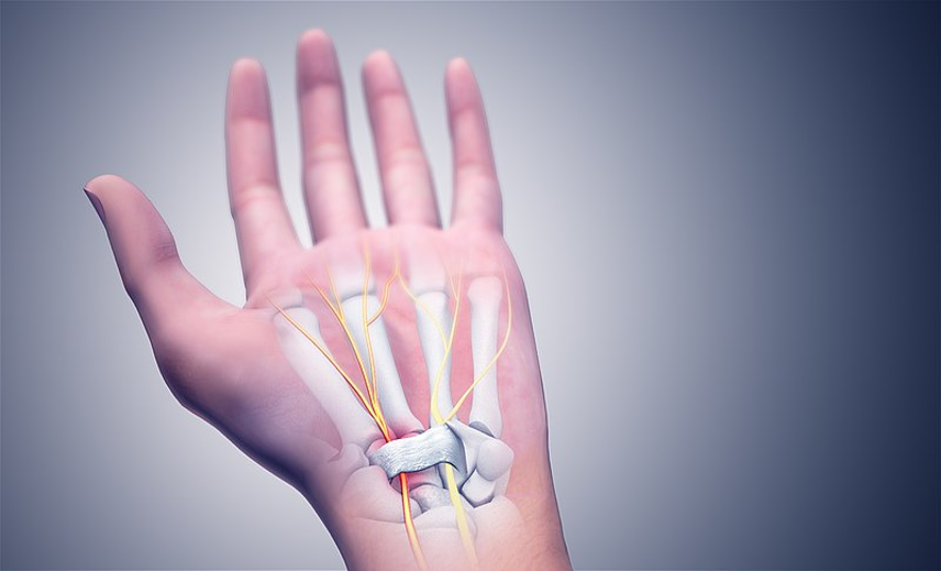 Get Relief from Carpal Tunnel Syndrome
