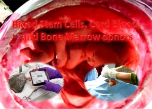 Bone Marrow Donors