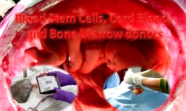 Bone Marrow Donors