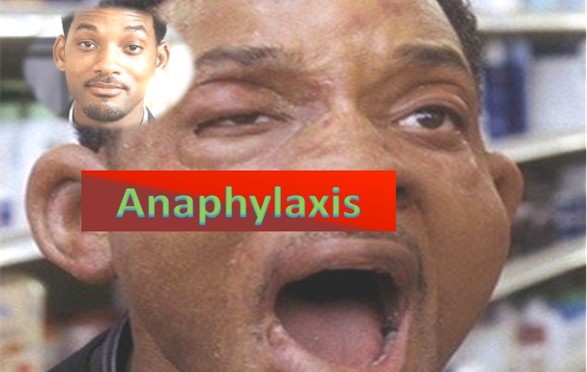 Anaphylaxis