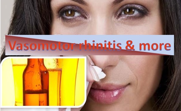 Vasomotor Rhinitis & more