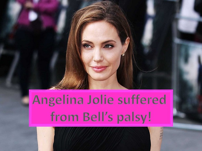 Angelina Jolie suffered from Bell’s Palsy