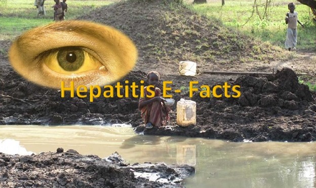 Hepatitis E virus
