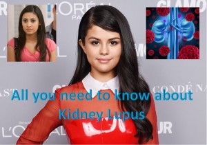 Selena Gomez’s kidney transplant due to Kidney Lupus