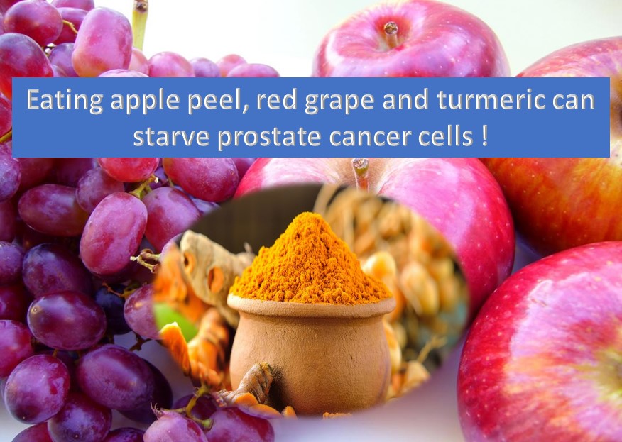 How to starve and kill prostate cancer cells?