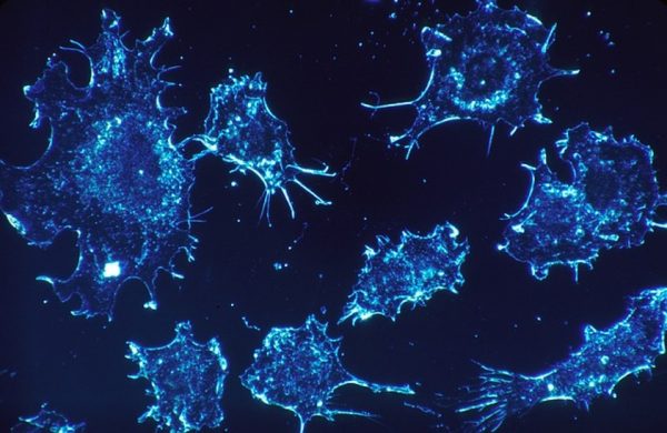 Customized Viruses stimulate the Immune system to fight Cancer