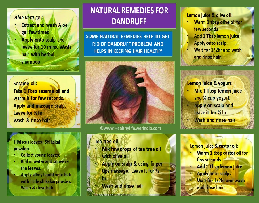Natural Remedies for Dandruff | HealthyLife | WeRIndia