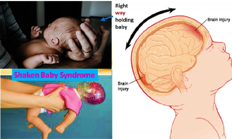 shaken-baby-syndrome-what-is-it-healthylife-werindia