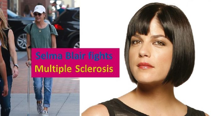 Actress Selma Blair Fights MS - HealthyLife | WeRIndia