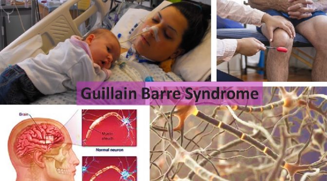Guillain Barre Syndrome