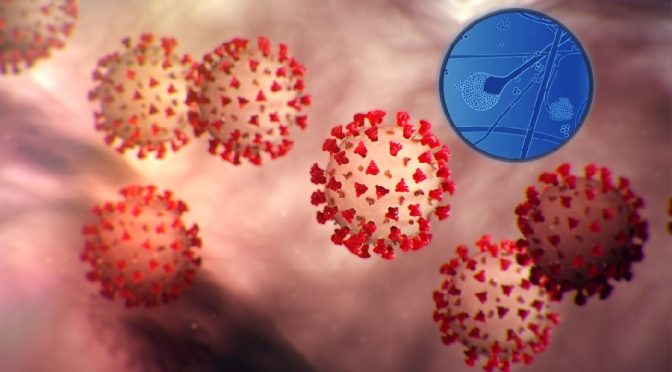 Mucormycosis fungal infection in covid patients