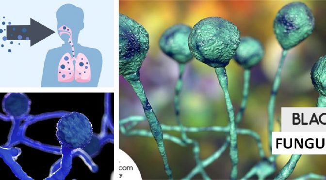 Black fungus guidelines