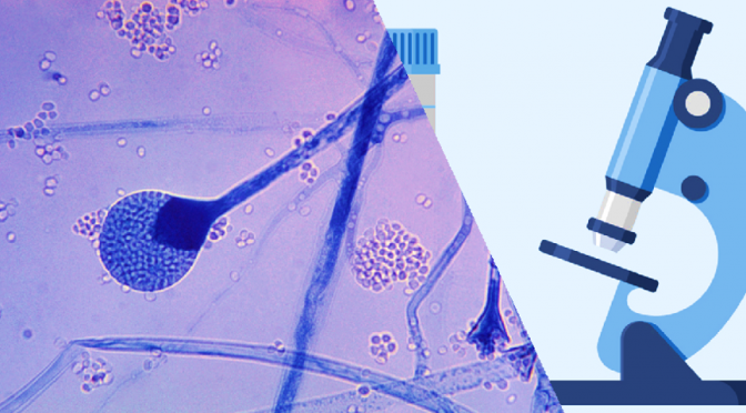 Diagnosis of Mucormycosis