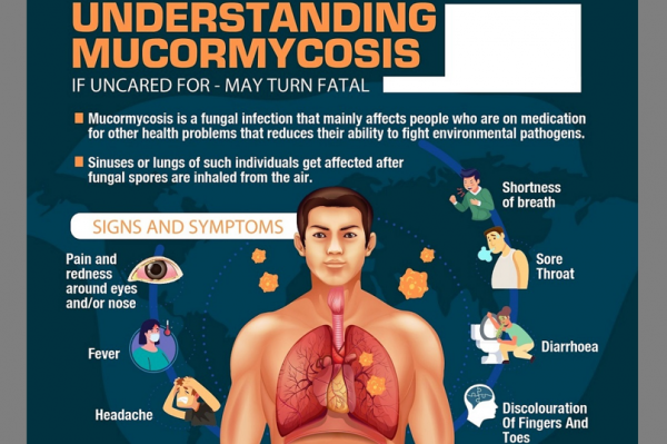 Symptoms of rhinocerebral and pulmonary Mucormycosis