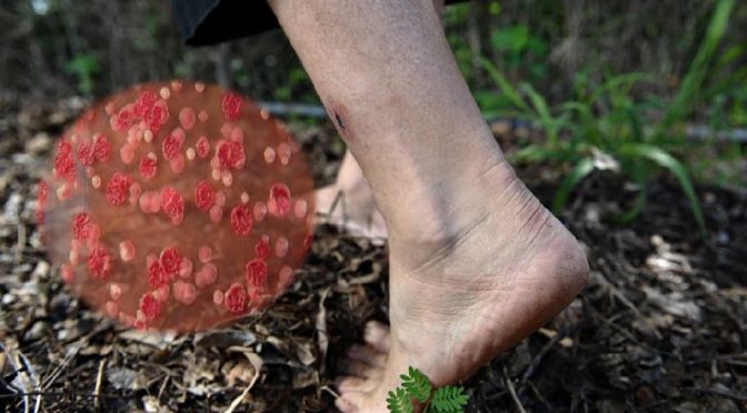 Melioidosis infection in USA