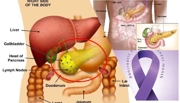 Pancreatic cancer awareness