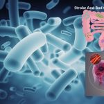 Bad gut bacteria and stroke