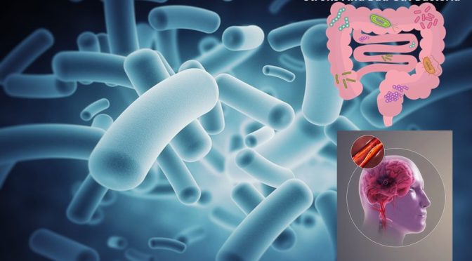 Bad gut bacteria and stroke