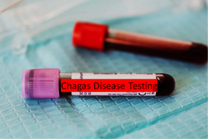 Chagas Disease Testing