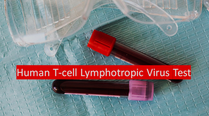 HTLV -Human T-cell Lymphotropic Virus Presence Test