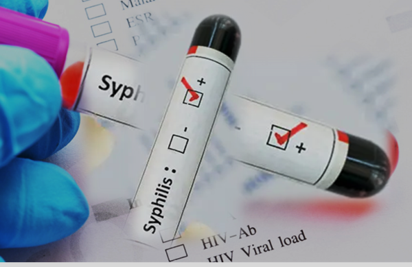 Syphilis Infection Testing