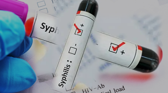 Syphilis Infection Testing