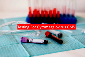 Testing For Cytomegalovirus CMV