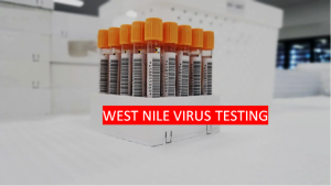 West Nile Virus Infection Testing