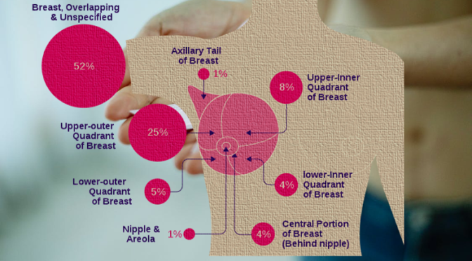 Understanding Breast Cancer Risk Factors And Prevention Strategy