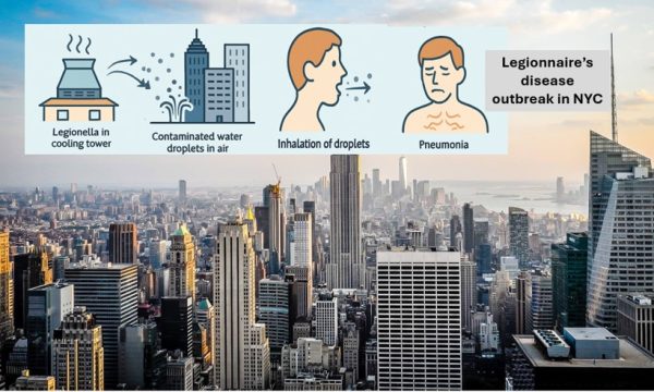 Legionnaire's disease in NYC