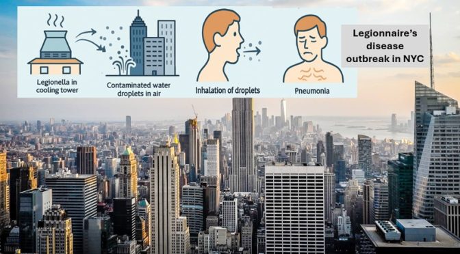 Legionnaire's disease in NYC