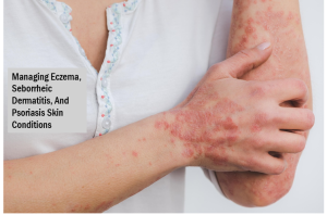 Managing Eczema, Seborrheic Dermatitis, And Psoriasis Skin Conditions